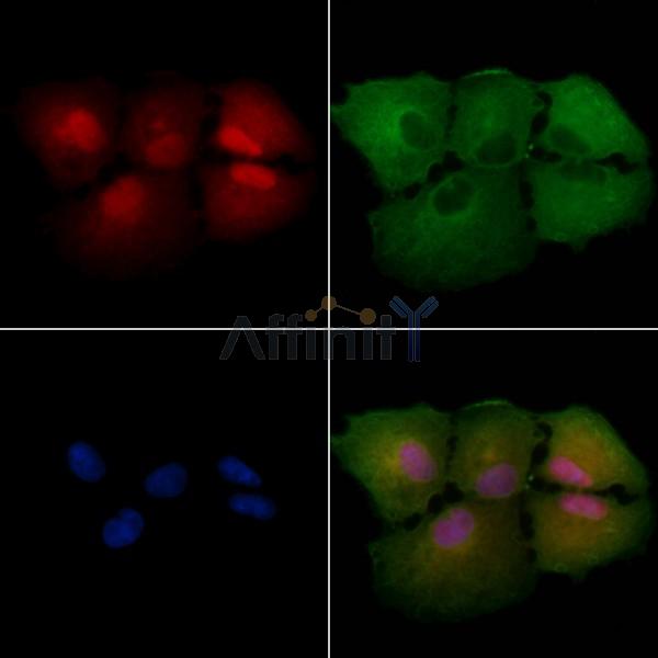 EPB41 Antibody - DF2226 staining A549 cells by IF/ICC.