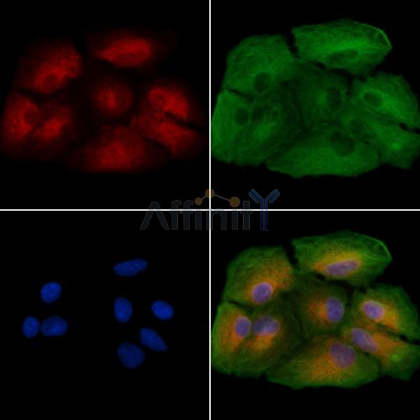 CCNY Antibody - DF2290 staining A549 cells by IF/ICC.