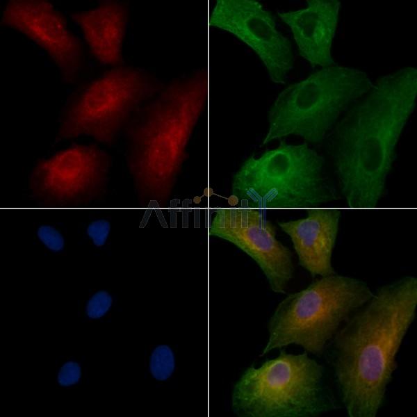 GPR56 Antibody - DF2753 staining A549 cells by IF/ICC.