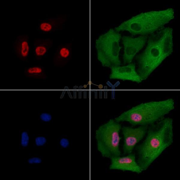 FUBP1 Antibody - DF2924 staining A549 cells by IF/ICC.