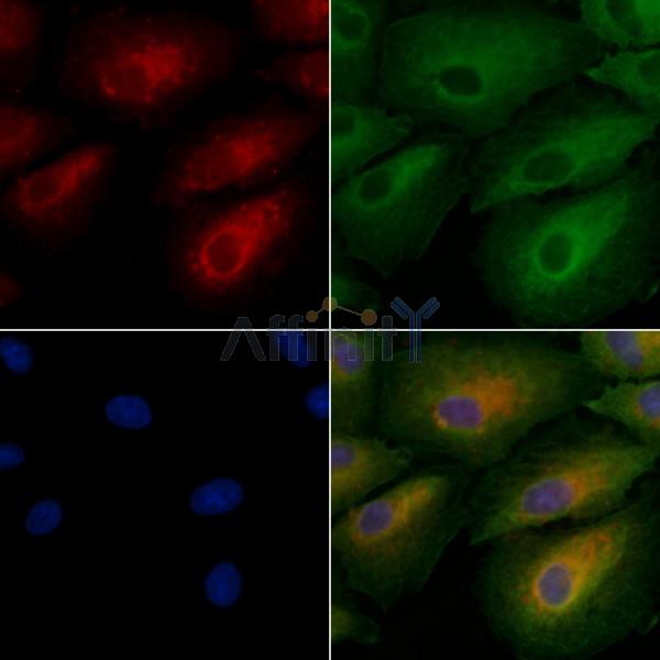 JAKMIP2 Antibody - DF3393 staining A549 cells by IF/ICC.