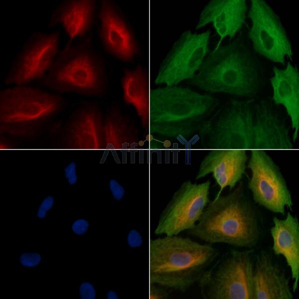 AARSD1 Antibody - DF3751 staining A549 cells by IF/ICC.