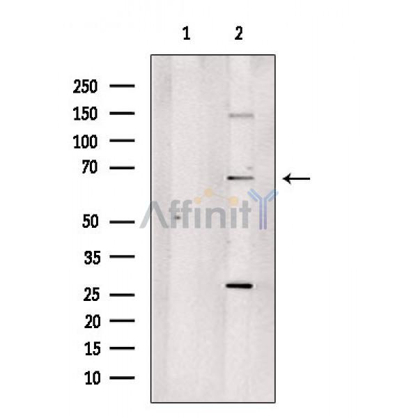 DDX55 Antibody - Western blot analysis of extracts from A375 cells, using DDX55 Antibody.