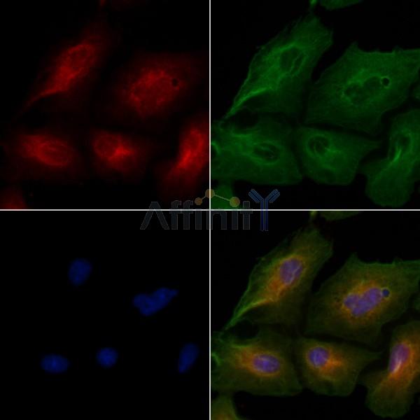 CEP76 Antibody - DF3921 staining A549 cells by IF/ICC.