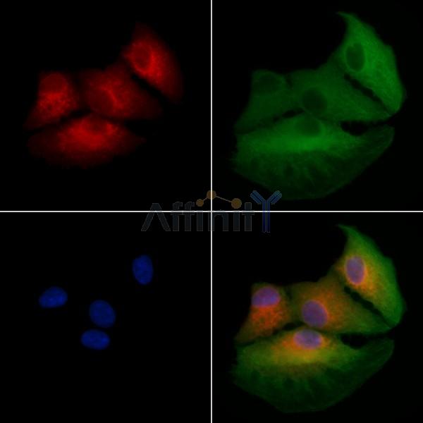 DNAJC5 Antibody - DF4011 staining A549 cells by IF/ICC.