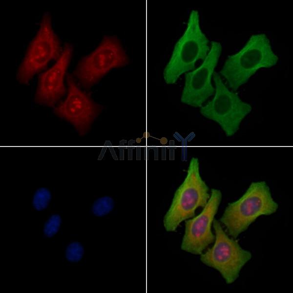 NOLC1 Antibody - DF4264 staining Hela cells by IF/ICC.