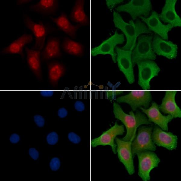 OGFR Antibody - DF4267 staining Hela cells by IF/ICC.