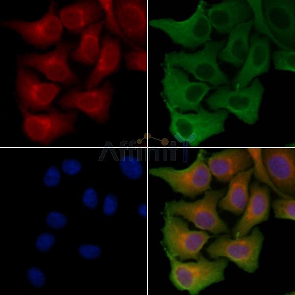 SLC6A15 Antibody - DF4272 staining Hela cells by IF/ICC.