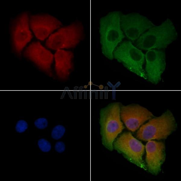 ZDHHC7 Antibody - DF4276 staining Hela cells by IF/ICC.