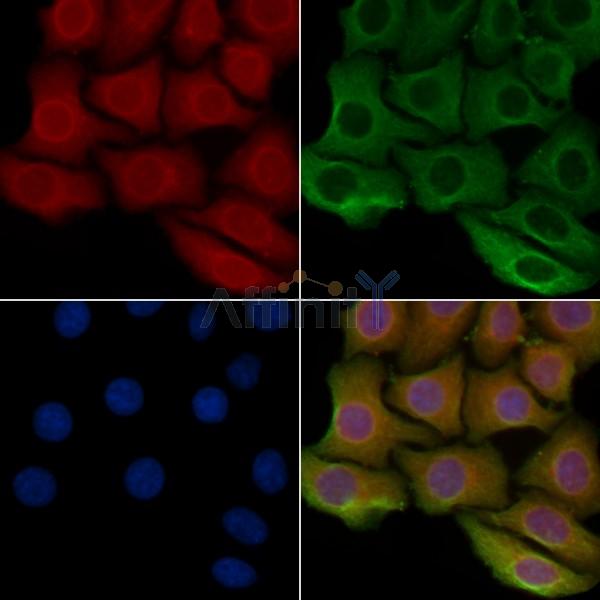 PITPNB Antibody - DF4291 staining Hela cells by IF/ICC.