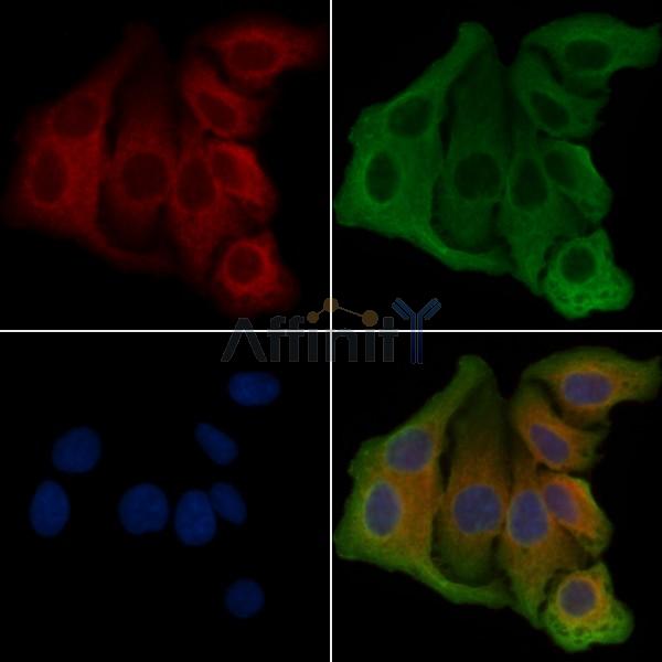 PKP4 Antibody - DF4298 staining Hela cells by IF/ICC.