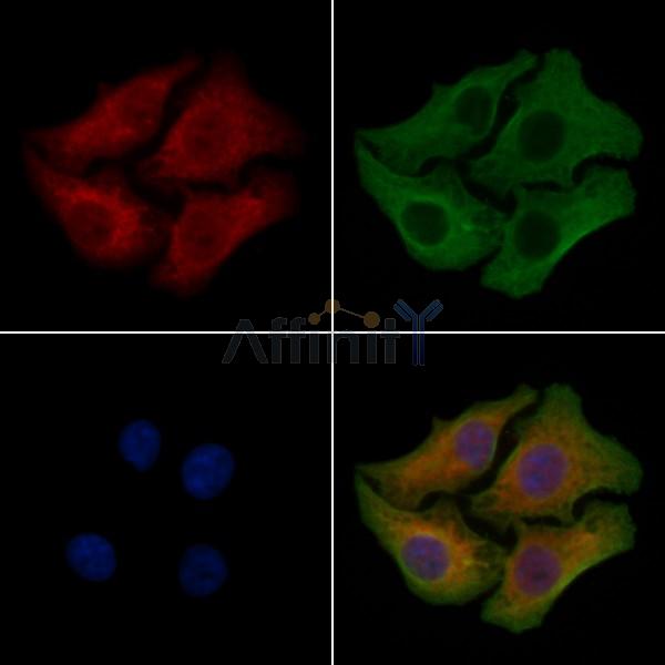 ZDHHC20 Antibody - DF4335 staining Hela cells by IF/ICC.