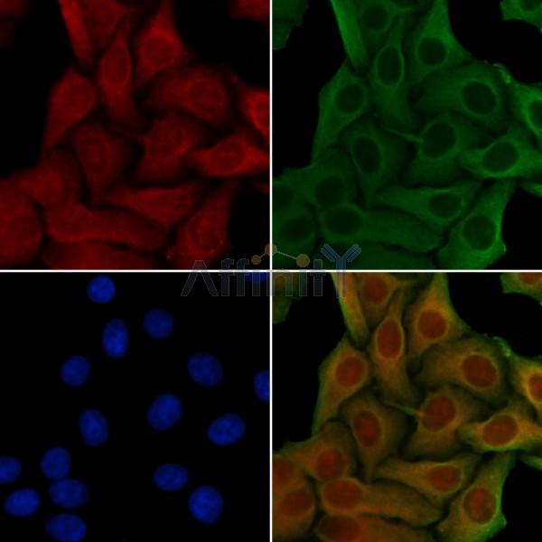 NDRG3 Antibody - DF4340 staining Hela cells by IF/ICC.