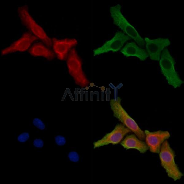 PPP1R16B Antibody - DF4342 staining Hela cells by IF/ICC.