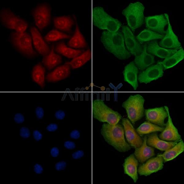 PPP1R14D Antibody - DF4343 staining Hela cells by IF/ICC.