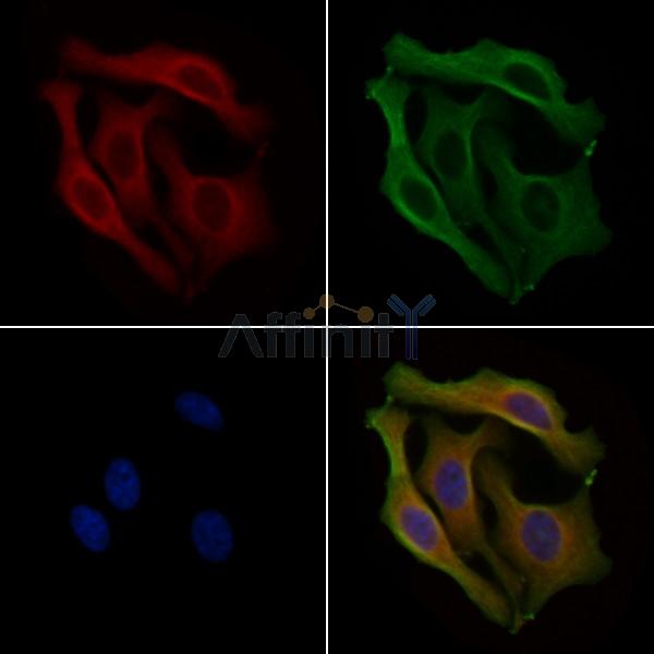 PPP1R3A Antibody - DF4345 staining Hela cells by IF/ICC.