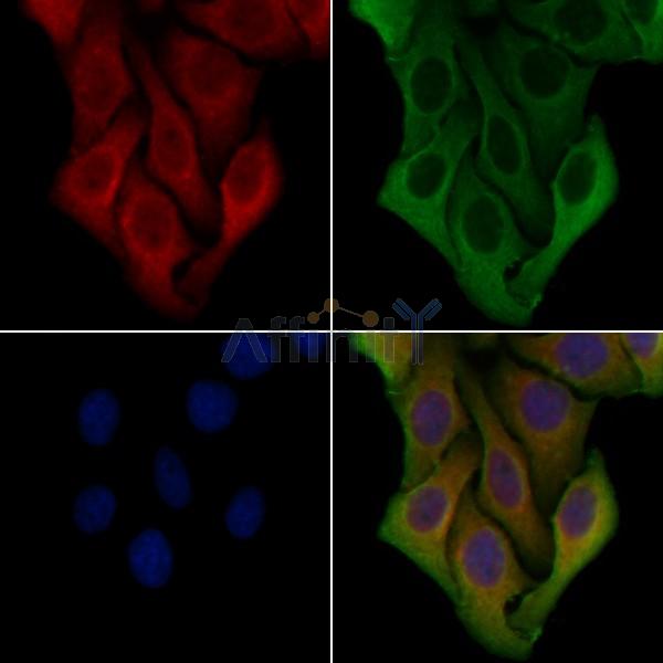 PPP1R3C Antibody - DF4346 staining Hela cells by IF/ICC.