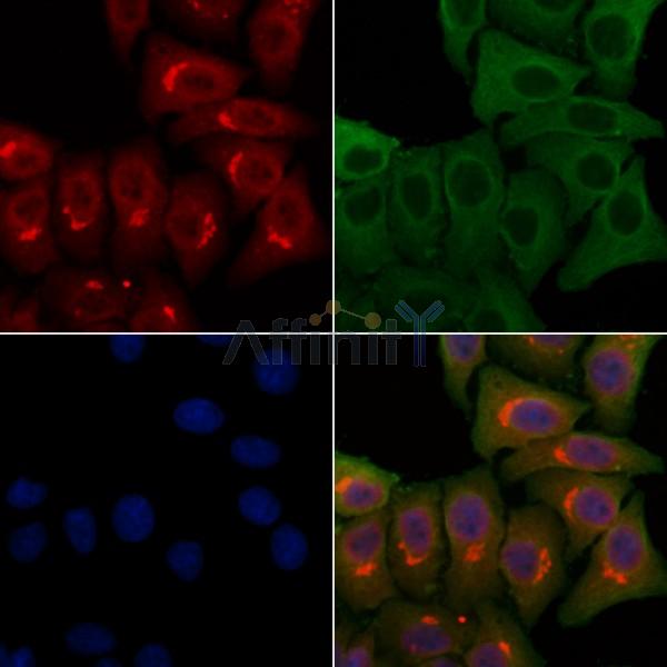 PMS2/PMS2CL Antibody - DF4351 staining Hela cells by IF/ICC.