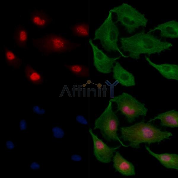 RED Antibody - DF4352 staining A549 cells by IF/ICC.