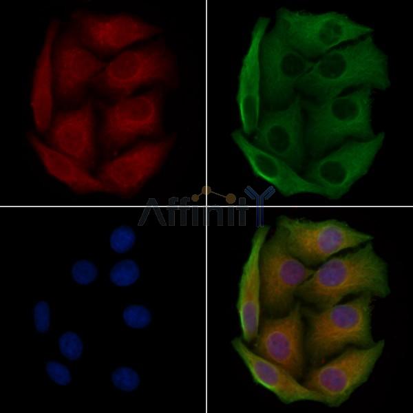 S100A7L2 Antibody - DF4356 staining Hela cells by IF/ICC.