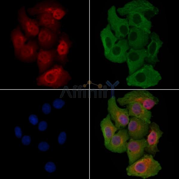 RANBP6 Antibody - DF4380 staining Hela cells by IF/ICC.