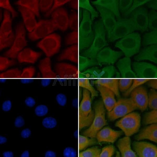 RAB26 Antibody - DF4398 staining Hela cells by IF/ICC.