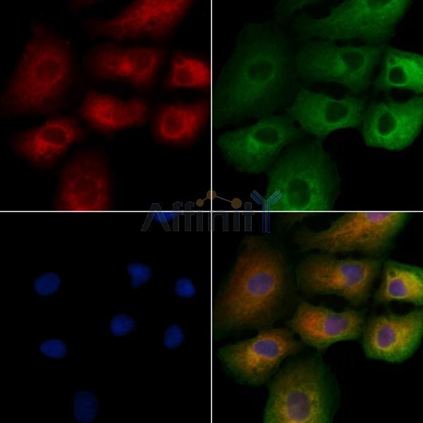 RAB2B Antibody - DF4400 staining A549 cells by IF/ICC.