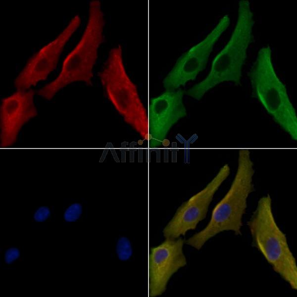 ARHGAP11A Antibody - DF4425 staining A549 cells by IF/ICC.