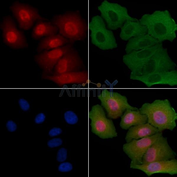 PPP4R2 Antibody - DF4488 staining Hela cells by IF/ICC.