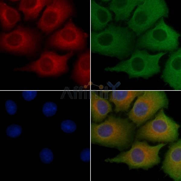 SH3GL2 Antibody - DF4505 staining Hela cells by IF/ICC.