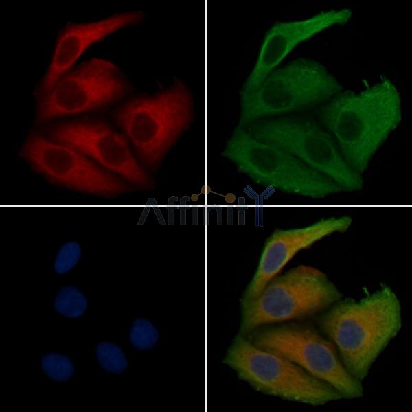 SNX1 Antibody - DF4536 staining Hela cells by IF/ICC.