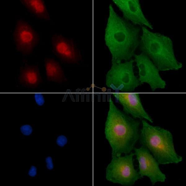 ZNF420 Antibody - DF4627 staining A549 cells by IF/ICC.