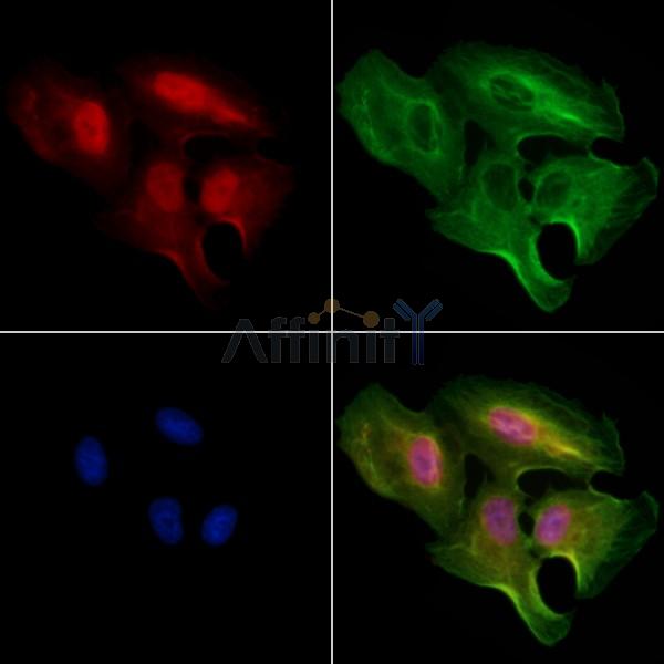 ZNF460 Antibody - DF4628 staining A549 cells by IF/ICC.