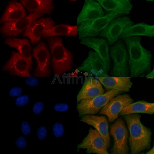 SLC39A9 Antibody - DF4636 staining Hela cells by IF/ICC.