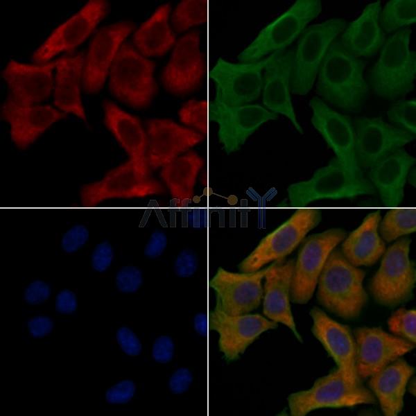 LIPB1 Antibody - DF4665 staining Hela cells by IF/ICC.