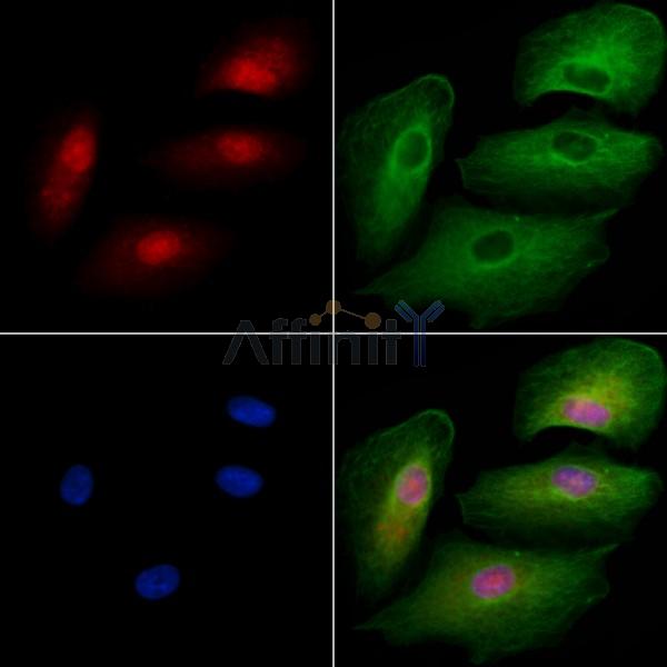 ZNF446 Antibody - DF4685 staining A549 cells by IF/ICC.