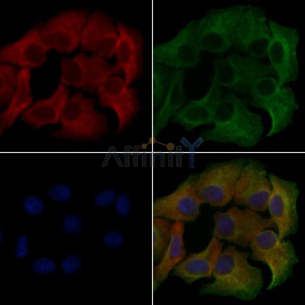 IL18R1 Antibody - DF4712 staining Hela cells by IF/ICC.