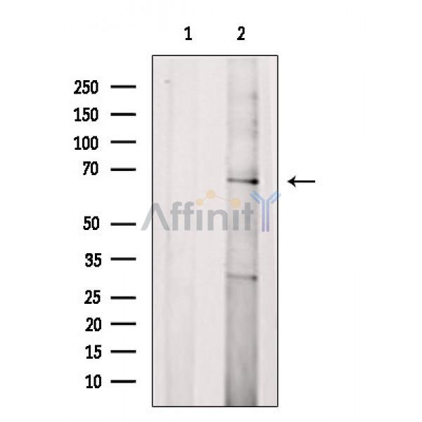 IL18R1 Antibody - Western blot analysis of extracts from A2780 cells, using IL18R Antibody.