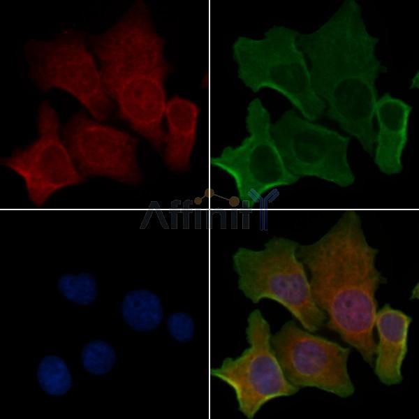 CNNM2 Antibody - DF4734 staining Hela cells by IF/ICC.
