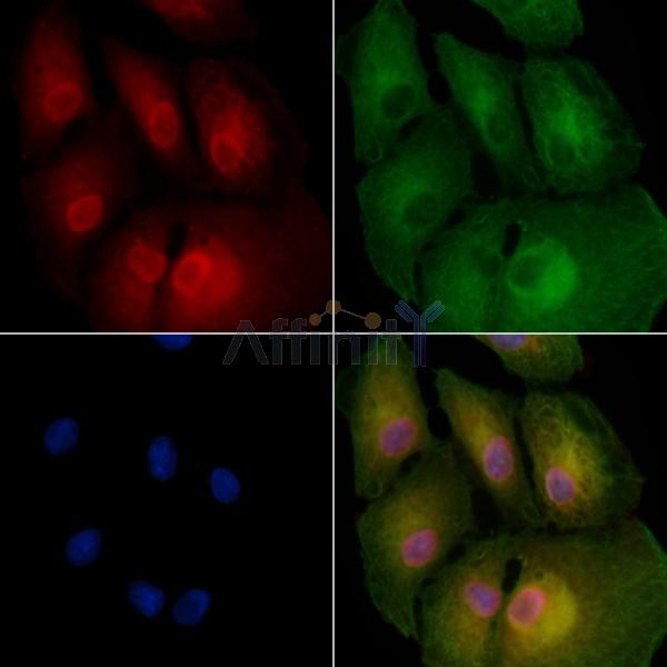 BCL7A Antibody - DF4737 staining A549 cells by IF/ICC.