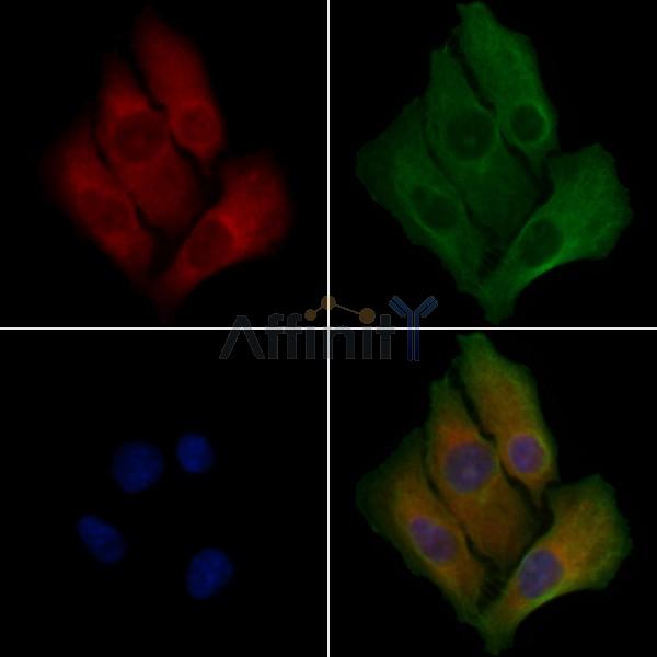 Cytochrome P450 20A1 Antibody - DF4760 staining Hela cells by IF/ICC.