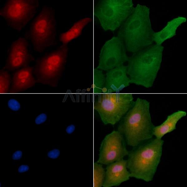 MAGEC2 Antibody - DF4772 staining A549 cells by IF/ICC.
