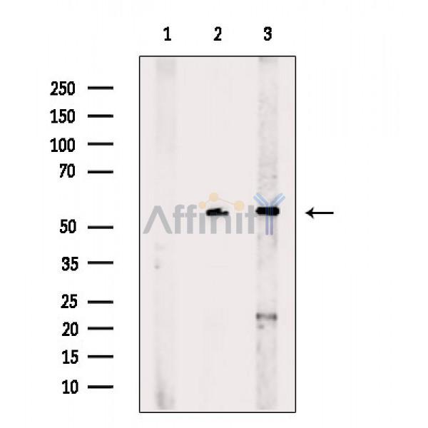 MAGEC2 Antibody - Western blot analysis of extracts from various samples, using MAGEC2 Antibody.
