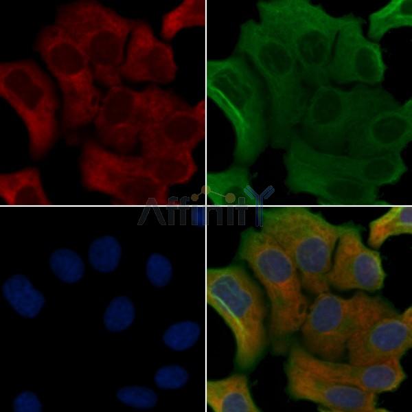 CDC42BPA Antibody - DF4786 staining Hela cells by IF/ICC.