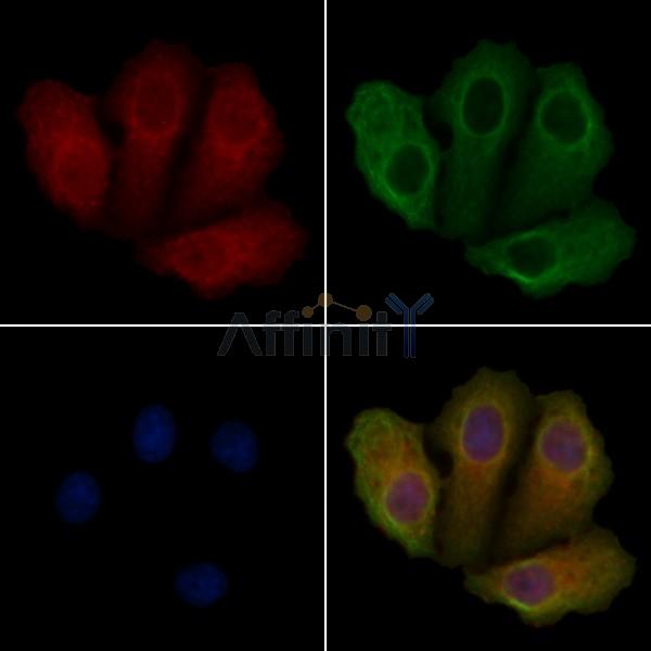 STK33 Antibody - DF4791 staining Hela cells by IF/ICC.