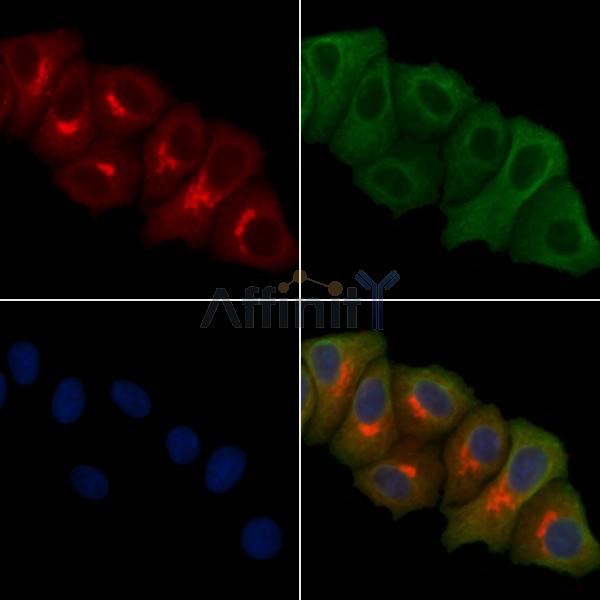 ERI1 Antibody - DF4800 staining Hela cells by IF/ICC.