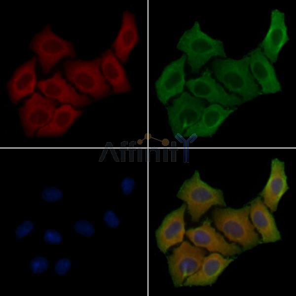 SLC44A1 Antibody - DF4805 staining Hela cells by IF/ICC.