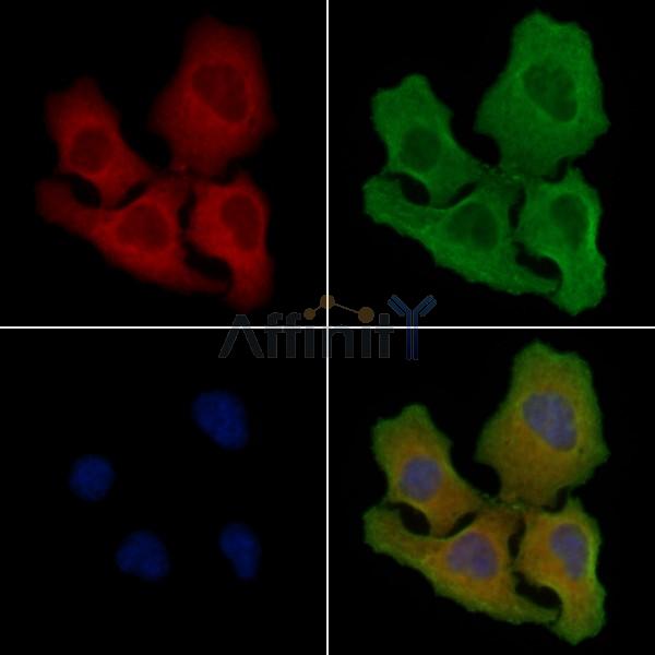 CLM-1 Antibody - DF4813 staining Hela cells by IF/ICC.