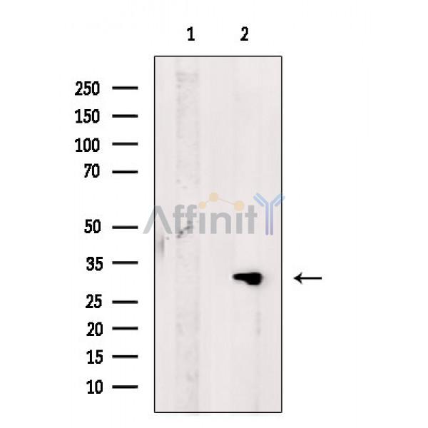 CLM-1 Antibody - Western blot analysis of extracts from A375 cells, using CLM-1 Antibody.