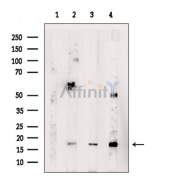 IL21 Antibody - Western blot analysis of extracts from various samples, using IL21 Antibody.